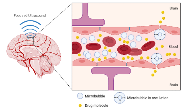 New method proposed for the assessment of focused ultrasound-induced blood-brain barrier opening outcomes