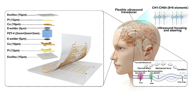生医工学院彭畅课题组研发柔性颅骨贴附超声系统，为无需开颅精准入脑治疗提供新方案